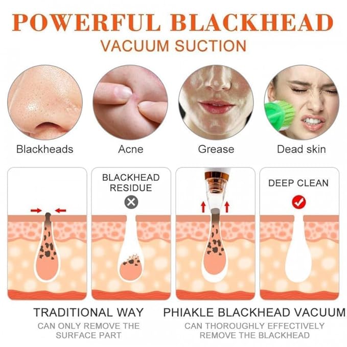 Goodingztore Blackhead Remover – Pore Vacuum Cleaner for Face
