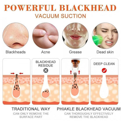 Goodingztore Blackhead Remover – Pore Vacuum Cleaner for Face