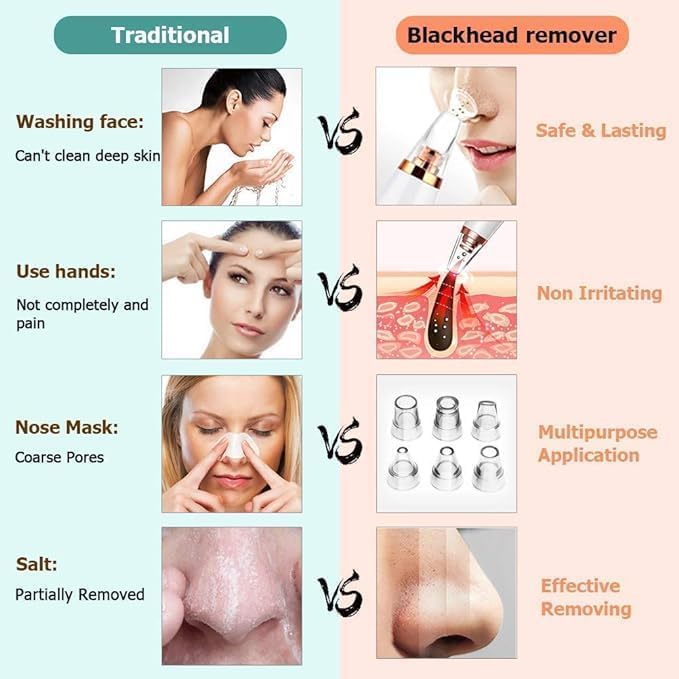 Goodingztore Blackhead Remover – Pore Vacuum Cleaner for Face