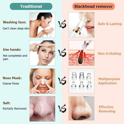 Goodingztore Blackhead Remover – Pore Vacuum Cleaner for Face